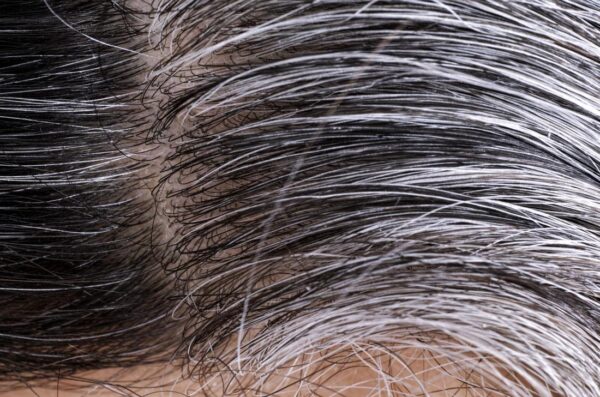 Unveiling the Mysteries: Understanding the Causes of White Hair and Natural Prevention Methods